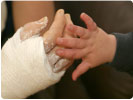 Personal Injury - other injuries